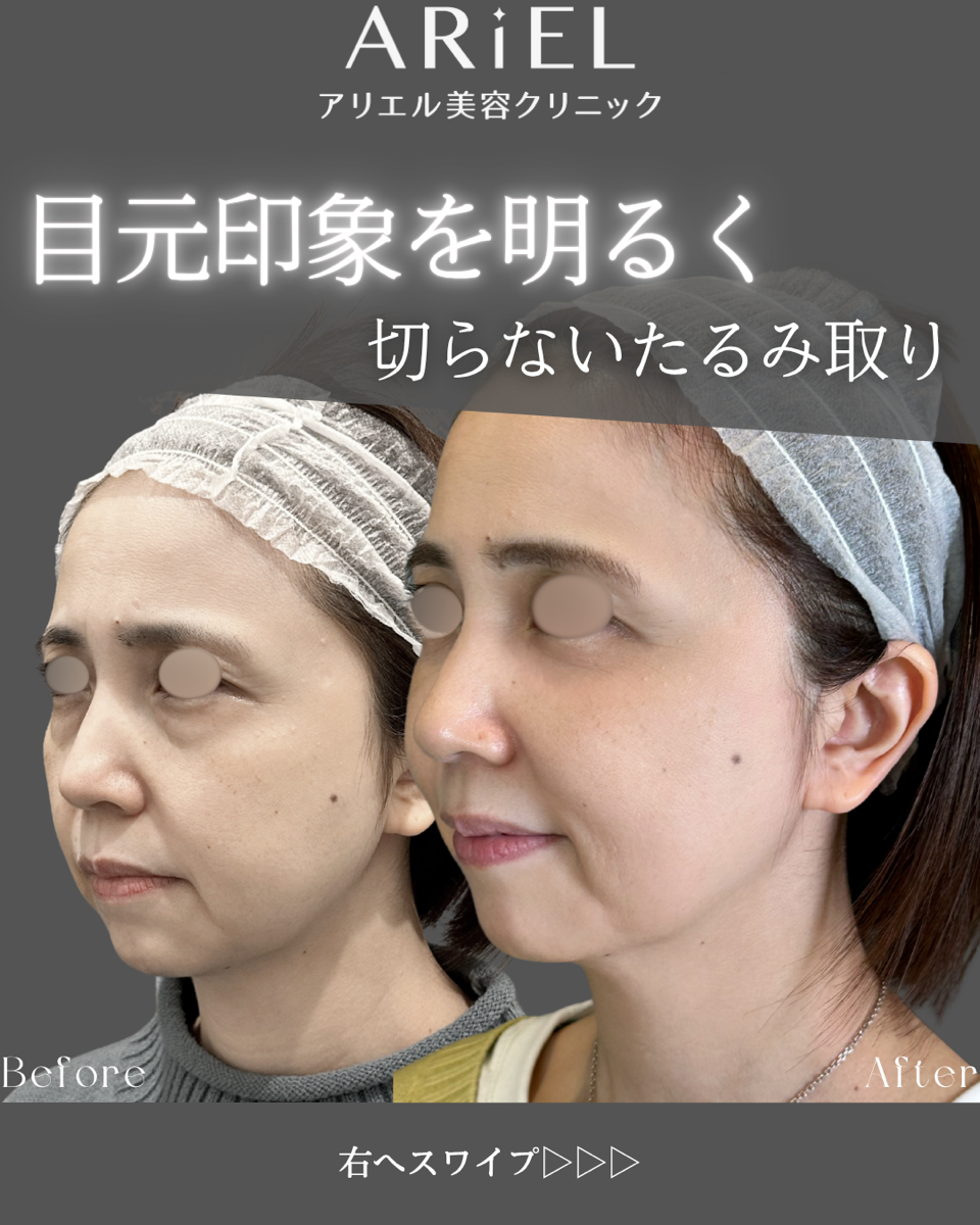 No.9122の症例写真